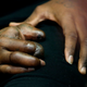 Illustration for article titled Take Your First Good Look At Jason Pierre-Pauls Mangled Hand
